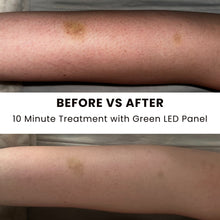 Load image into Gallery viewer, Illuminate Green Light Therapy Pannel